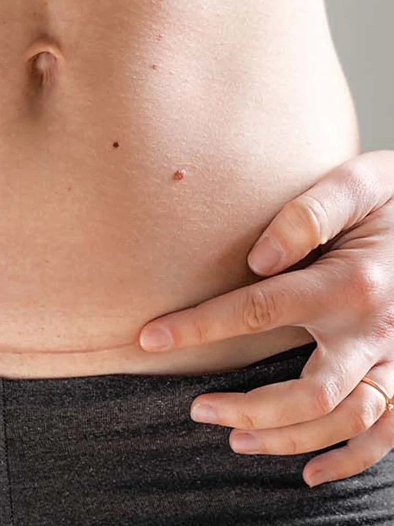 C-sections: All you need to know